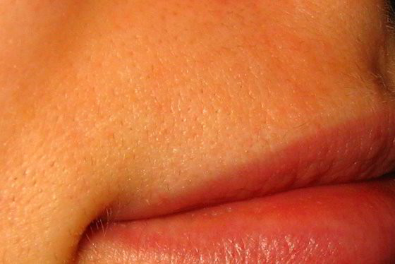 Как часто делать депиляцию верхней губы